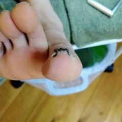 矯正後の右足親指の爪