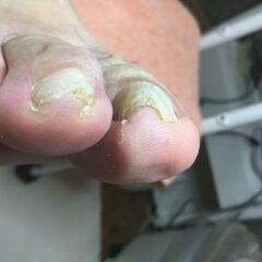 矯正前
