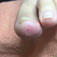 矯正前