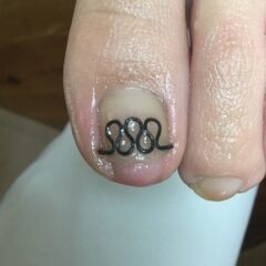矯正後