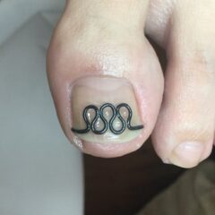 矯正後