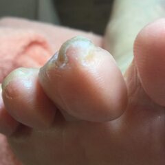 爪切り後