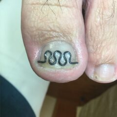 矯正後