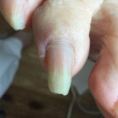 爪切り前