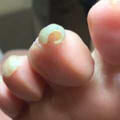 爪切り前