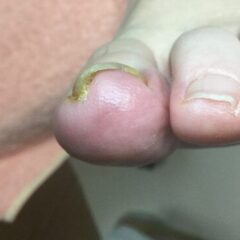 矯正前