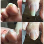 【爪切り】ビフォーアフター
