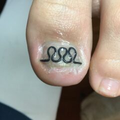 矯正後