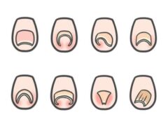 足の爪のカーブ形状の例(複数パターン)