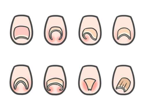 爪の形いろいろ
