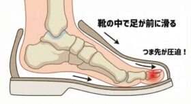 靴の中で足が前に滑って、つま先が靴にぶつかっている状態