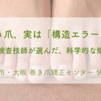 その巻き爪、爪の「構造エラー」です。 臨床検査技師が「物理」で見抜く、痛みの正体