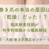 巻き爪の本当の原因は「乾燥」だった!? 臨床検査技師が科学的根拠から徹底解説