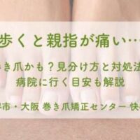 巻き爪かも？見分け方と対処法 病院に行く目安も解説