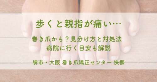 巻き爪かも？見分け方と対処法 病院に行く目安も解説