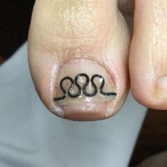 矯正後