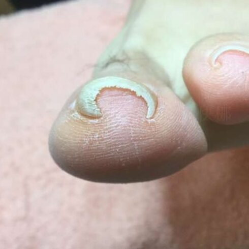 矯正前