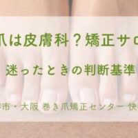 巻き爪は何科に行けばいいか、皮膚科に行くべき症状と矯正サロンで相談できるケースを解説する画像