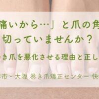 深爪が巻き爪を悪化させる理由と正しい予防法