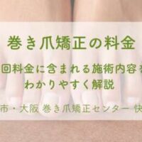 堺市の巻き爪矯正センター快梛|初回料金に含まれる施術内容を解説