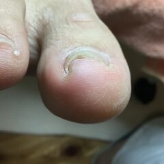矯正前